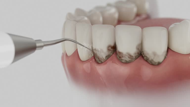 Reliable Dental Implants contractor in Flomaton, AL by Smile Center Dentistry